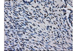 Immunohistochemical staining of paraffin-embedded colon tissue using anti-RPA2 mouse monoclonal antibody. (RPA2 Antikörper)