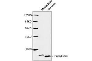 Western blot analysis of tissue lysates using 1 µg/mL Rabbit Anti-Parvalbumin Polyclonal Antibody (ABIN398923) The signal was developed with IRDye-800 Conjugated Goat Anti-Rabbit IgG. (PVALB Antikörper)