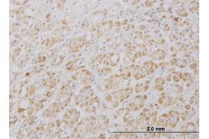 Immunoperoxidase of monoclonal antibody to DKFZp761P0423 on formalin-fixed paraffin-embedded human adrenal gland. (PRAGMIN Antikörper  (AA 2-101))