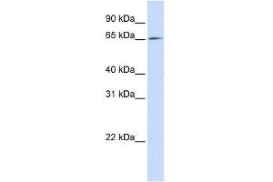 WB Suggested Anti-NET1 Antibody Titration: 0. (NET1 Antikörper  (N-Term))