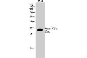 Western Blot (WB) analysis of A549 cells using Acetyl-ATF-5 (K29) Polyclonal Antibody. (ATF5 Antikörper  (acLys29))