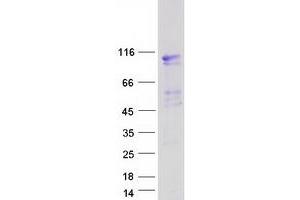 Validation with Western Blot (EVI5L Protein (Myc-DYKDDDDK Tag))