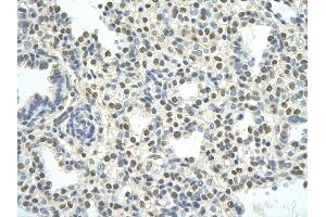 Rabbit Anti-PATZ1 antibody         Paraffin Embedded Tissue:  Human Lung    cell Cellular Data:  alveolar cell    Antibody Concentration:  4.