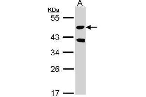 WB Image Sample (30 ug of whole cell lysate) A: Raji 10% SDS PAGE antibody diluted at 1:1000 (STK24 Antikörper)