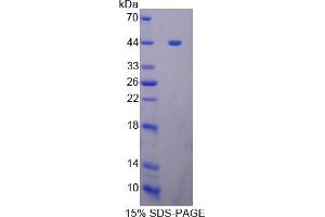 Image no. 1 for Zinc Finger Protein GLI1 (GLI1) (AA 810-1109) protein (His tag) (ABIN6238202) (GLI1 Protein (AA 810-1109) (His tag))