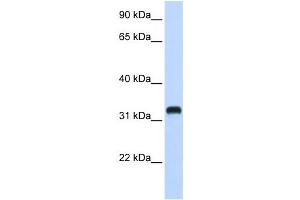 Western Blotting (WB) image for anti-Chromosome 21 Open Reading Frame 62 (C21orf62) antibody (ABIN2458967) (C21orf62 Antikörper)