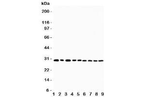 Western blot testing of OX40 antibody and Lane 1:  U87 (TNFRSF4 Antikörper  (N-Term))