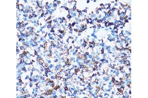 Immunohistochemistry (Paraffin-embedded Sections) (IHC (p)) image for anti-Sialophorin (SPN) antibody (ABIN7262234)