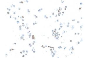 Immunocytochemistry (ICC) image for anti-Estrogen Receptor 1 (ESR1) antibody (ABIN7455134) (Estrogen Receptor alpha Antikörper)