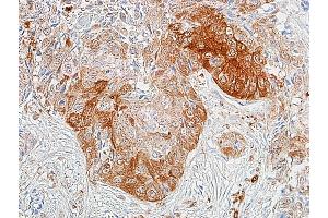 Immunohistochemistry (IHC) image for anti-Aldehyde Dehydrogenase 1 Family, Member A1 (ALDH1A1) (AA 300-350) antibody (ABIN7453956)