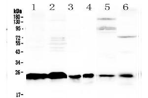 Western blot analysis of MED18 using anti-MED18 antibody . (MED18 Antikörper  (AA 1-208))