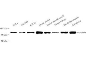 Western blot analysis of ACTN1 (ABIN7072905),at dilution of 1: 800 (ACTN1 Antikörper)