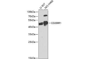 Western blot analysis of extracts of various cell lines, using CD200R1 antibody (ABIN6127574, ABIN6138139, ABIN6138140 and ABIN6224293) at 1:1000 dilution. (CD200R1 Antikörper  (AA 249-348))