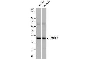 WB Image Ataxin 3 antibody detects Ataxin 3 protein by western blot analysis. (Ataxin 3 Antikörper)