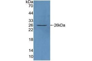 Detection of Recombinant FAM3C, Human using Polyclonal Antibody to Family With Sequence Similarity 3, Member C (FAM3C) (FAM3C Antikörper  (AA 25-227))