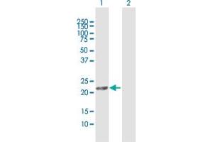 Western Blot analysis of MGC4172 expression in transfected 293T cell line by MGC4172 MaxPab polyclonal antibody. (DHRS11 Antikörper  (AA 1-181))