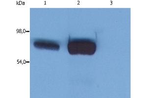 Western Blotting analysis (reducing conditions) of whole cell lysate using anti-SLP76 (SLP-76/03).