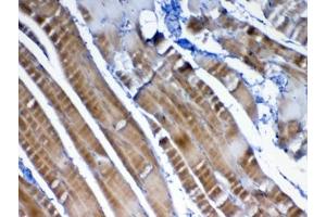 IHC testing of FFPE rat skeletal muscle tissue with VEGFB antibody at 1ug/ml. (VEGFB (VEGF2) Antikörper)