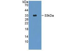 Western blot analysis of recombinant Rat OAS1. (OAS1 Antikörper  (AA 139-358))