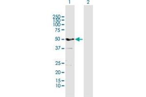 Western Blot analysis of ALDH3A1 expression in transfected 293T cell line by ALDH3A1 MaxPab polyclonal antibody. (ALDH3A1 Antikörper  (AA 1-453))