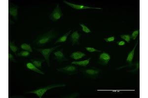 Immunofluorescence of purified MaxPab antibody to ELAVL1 on HeLa cell. (ELAVL1 Antikörper  (AA 1-326))