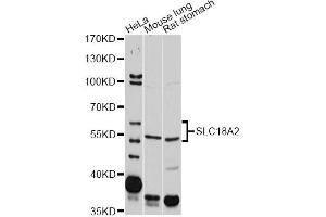 Western blot analysis of extracts of various cell lines, using SLC18A2 antibody (ABIN1874806) at 1:2000 dilution. (SLC18A2 Antikörper)