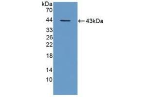 Detection of Recombinant TPP1, Mouse using Polyclonal Antibody to Tripeptidyl Peptidase I (TPP1) (TPP1 Antikörper  (AA 198-562))