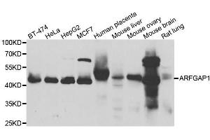 Western blot analysis of extracts of various cell lines, using ARFGAP1 antibody. (ARFGAP1 Antikörper  (AA 1-220))