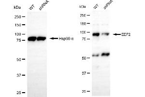 Western blotting analysis using EEF2 antibody (ABIN7798501). (EEF2 Antikörper)