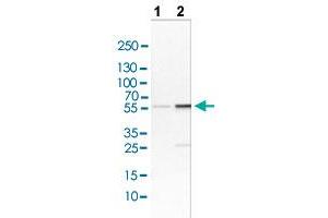Western blot analysis of Lane 1: NIH/3T3 cell lysate and Lane 2: NBT-II cell lysate with LYN polyclonal antibody .