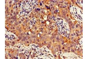 Immunohistochemistry (IHC) image for anti-Guanine Nucleotide Binding Protein (G Protein), beta Polypeptide 4 (GNB4) (AA 105-185) antibody (ABIN7154741)