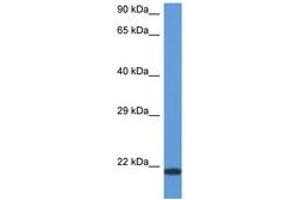 Image no. 1 for anti-CD70 Molecule (CD70) (AA 31-80) antibody (ABIN6747332)