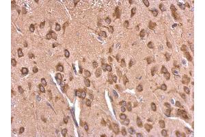 IHC-P Image EEF1A2 antibody detects EEF1A2 protein at cytosol on rat fore brain by immunohistochemical analysis. (EEF1A2 Antikörper)