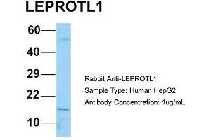 Host: Rabbit Target Name: LEPROTL1 Sample Type: Human HepG2 Antibody Dilution: 1. (LEPROTL1 Antikörper  (N-Term))