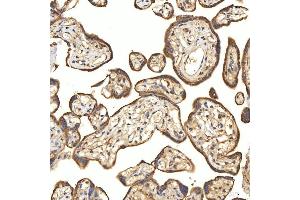 IHC analysis of Citrin/SLC25A13 using anti-Citrin/SLC25A13 antibody (ABIN7599512). (slc25a13 Antikörper  (AA 1-643))