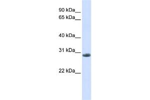 WB Suggested Anti-YIPF6 Antibody Titration:  0. (YIPF6 Antikörper  (C-Term))