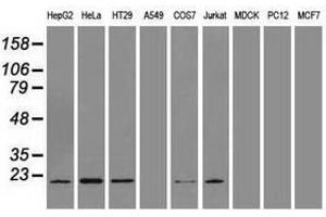 Image no. 2 for anti-Adenylate Kinase 1 (AK1) antibody (ABIN1496516) (Adenylate Kinase 1 Antikörper)