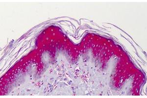 Human Skin: Formalin-Fixed, Paraffin-Embedded (FFPE)