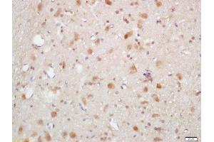 Formalin-fixed and paraffin embedded rat brain labeled with Rabbit Anti-AKT1/2/3 (Thr305/308/309) Polyclonal Antibody, Unconjugated (ABIN756052) at 1:200 followed by conjugation to the secondary antibody and DAB staining (AKT 1/2/3 Antikörper  (pThr305, pThr308, pThr309))