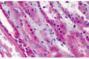 Human Kidney: Formalin-Fixed, Paraffin-Embedded (FFPE) (TRAF5 Antikörper  (AA 77-186))