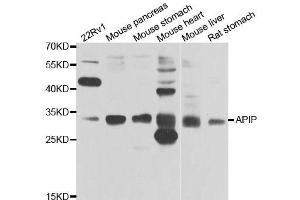 Western blot analysis of extracts of various cell lines, using APIP antibody. (APIP Antikörper  (AA 1-242))