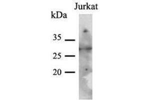 Image no. 1 for anti-Phenylethanolamine N-Methyltransferase (PNMT) (AA 1-282), (N-Term) antibody (ABIN954226)