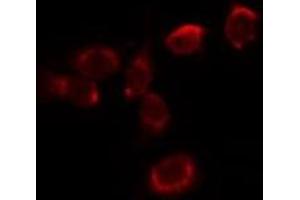ABIN6278025 staining HepG2 by IF/ICC. (Hemoglobin Alpha 1 + 2 (HBA1,HBA2) (Internal Region) Antikörper)