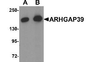 Western blot analysis of ARHGAP39 in A20 cell lysate with ARHGAP39 antibody at (A) 1 and (B) 2 µg/mL