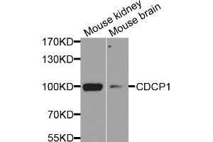 Western blot analysis of extracts of various cell lines, using CDCP1 antibody (ABIN5974536) at 1/1000 dilution. (CDCP1 Antikörper)