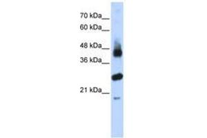 Image no. 1 for anti-F-Box and Leucine-Rich Repeat Protein 2 (FBXL2) (AA 71-120) antibody (ABIN6740795) (FBXL2 Antikörper  (AA 71-120))