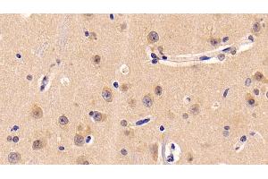 Immunohistochemistry (IHC) image for anti-Neuropilin 1 (NRP1) (AA 646-814) antibody (ABIN7425992)