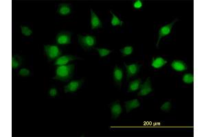 Immunofluorescence of monoclonal antibody to PDE6D on HeLa cell.