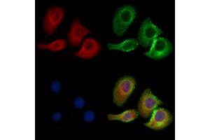 ABIN7094458 and ABIN7098506 staining Hela cells by IF/ICC. (CBX7 Antikörper  (N-Term))