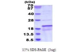 SDS-PAGE (SDS) image for Succinate Dehydrogenase Complex Assembly Factor 1 (SDHAF1) (AA 1-115) protein (His tag) (ABIN6387510)